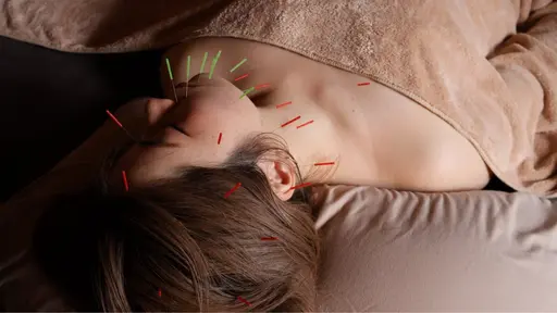 初回限定✨🎁即効小顔美容鍼｜首肩調整＋お顔集中コース 💎60分¥11,000→「¥6,900」