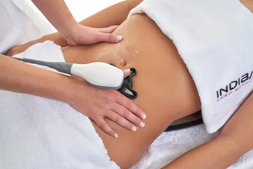 インディバ最新機種使用 インディバボディ60 ⭕️痩身⭕️温活⭕️脂肪吸引アフター⭕️妊活⭕️内臓ケア⭕️腰痛対策など