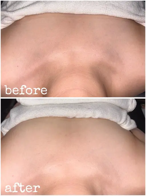 練習モデル 平日21時​〜​、土日祝19時30分​〜​ ブライダルシェービングコース（顔剃り×）施術内容確認してください