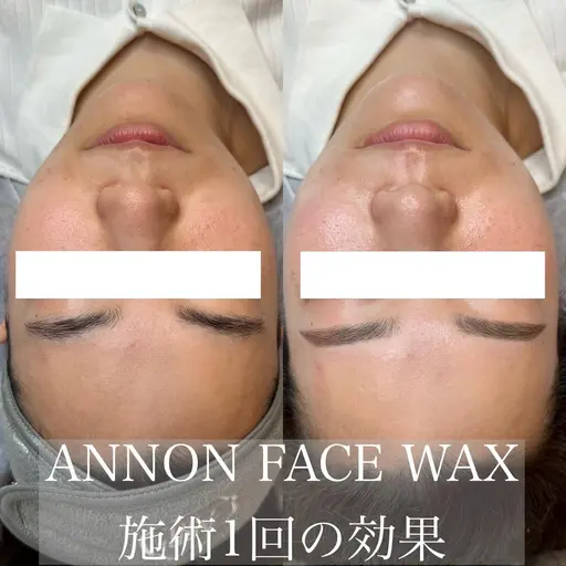 フェイシャルワックス