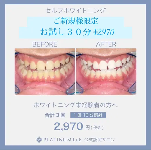 ご新規様限定🦷セルフホワイトニングお試し30分✨自然な清潔感ある白さを目指していきます💎メンズも大歓迎✨ ☝️