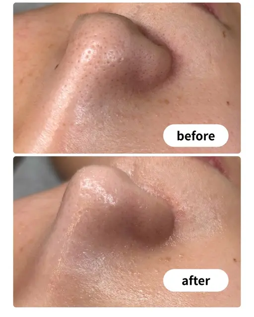 人気No.1 🌿美眉スタイリング＋毛穴洗浄・ニキビ鎮静