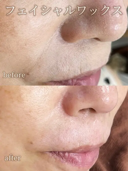 フェイシャルワックス