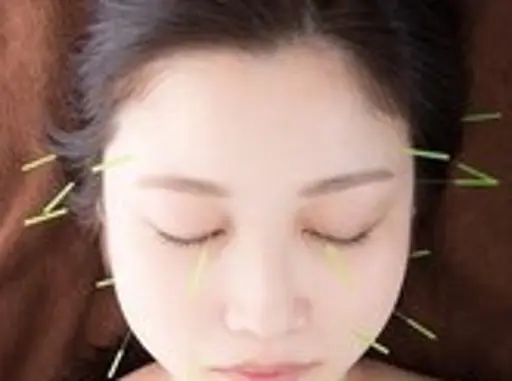 美容鍼+身体のメンテナンス60分