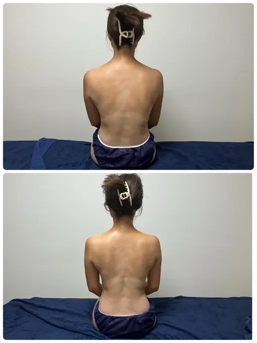 【12月クーポン】温活⛄️姿勢矯正ロミロミ痩身60分️+米ぬかカイロ(小サイズ)