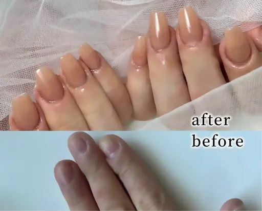 【深爪矯正】スカルプ長さだしで深爪さんも自然で細長いお爪の形に生まれ変われる🪄✨ワンカラーorグラデーション