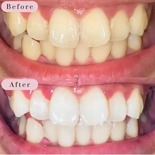 💎モニター限定💎スタンダードコース15分通常7,700円→0円✨