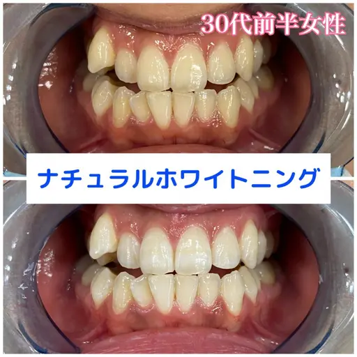 初めの方へオススメ‼️一度で効果を感じたい方へ‼️初回30分照射‼️