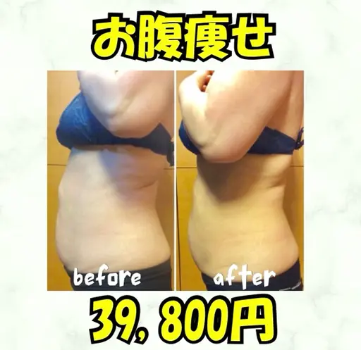 半永久🍋お腹痩せ1回39,800円！メンズも可能🉑痛みなし！