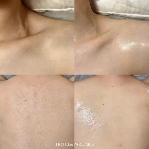 本日限定☀️【背中上うなじ込+デコルテワックス脱毛】