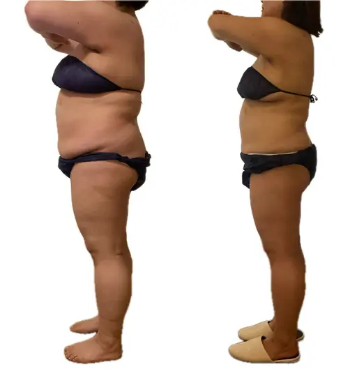 人気No. 1✨【本気で全身痩せたい◎】滝汗デトックス痩身🔥120分