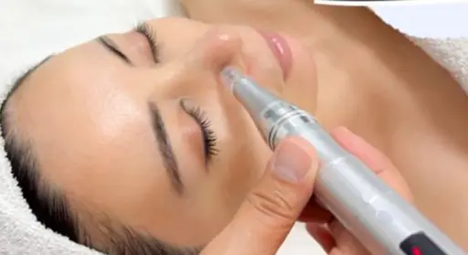 安全なダーマペンで肌のお悩みマイナスに！ニキビ跡、シワ、ハリ、肝斑にも⭕️な美容液をお肌へ。　大人気のサーモン美容液も♡