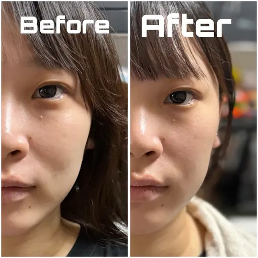 レビュー必須！！EMSリラク体験🌟首頭肩お任せください🌟