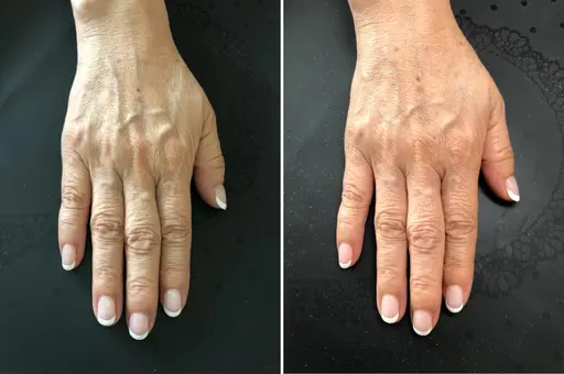 【全員】手の病院サロン、スタンダードコース