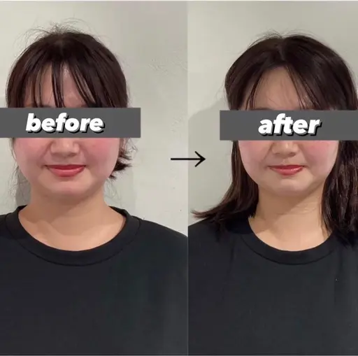 【成人式前限定👘🩶】即効小顔リフトアップコース💆‍♀️