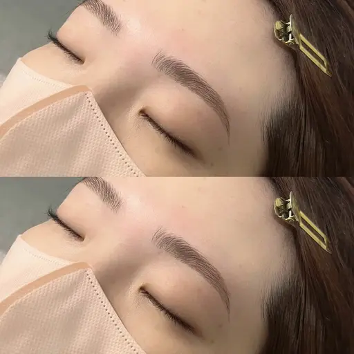 《ハリウッドブロウリフト》