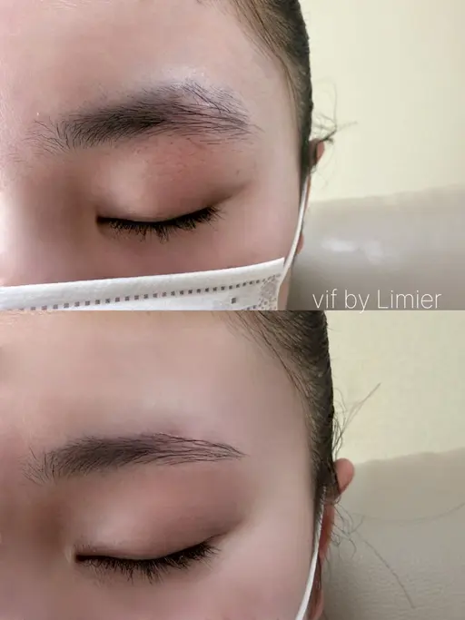 【新規限定】美眉wax脱毛