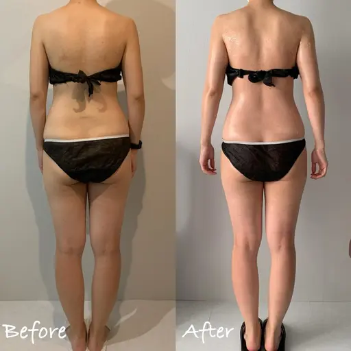 肩こり、浮腫、様々なお悩みの方やブライダルエステとしてもオススメ！オーダーメイド70分12100円→9900円