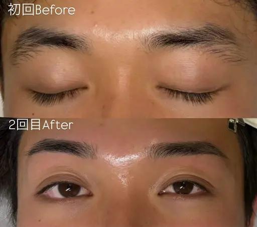 メンズ眉毛WAX脱毛