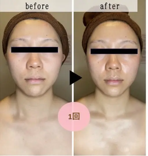 【むくみ｜顔コリ｜疲れ顔】小顔リンパマッサージ※おひとり様1回のみ