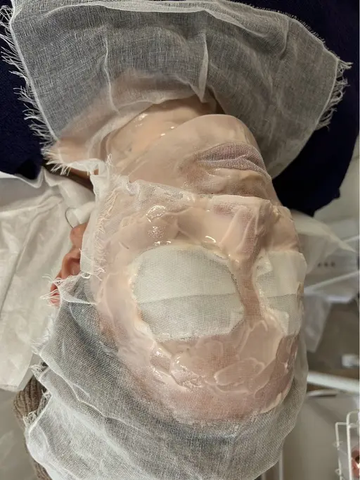 【1​〜​2月限定価格】潤い集中ケアコース