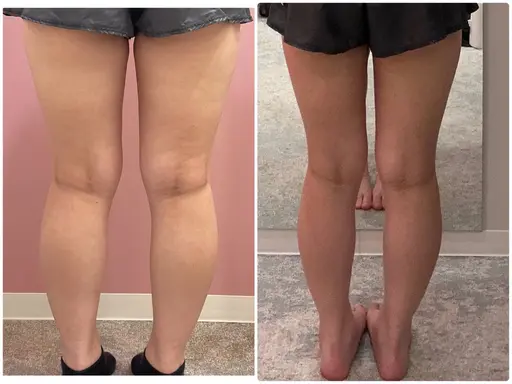 口コミ投稿必須　エステ初回体験（身体）