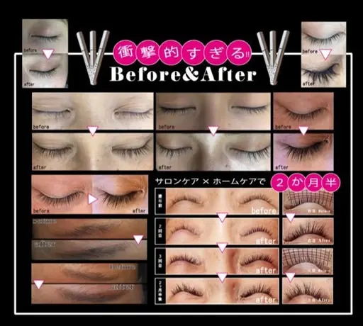 ❤︎超音波ソニック使用❤︎ラッシュアディクト×V3❤︎フェイシャルエステ(30分)💆‍♀️✨