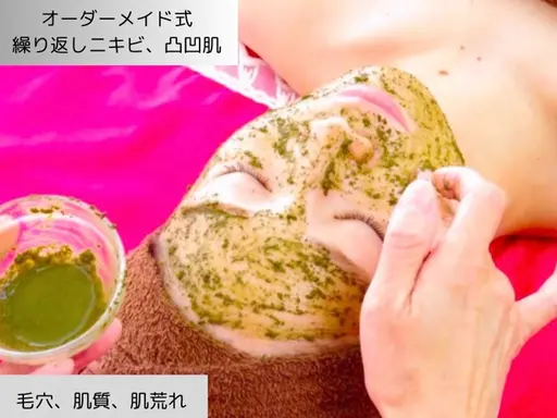 【繰り返しニキビ//凸凹肌徹底ケア 】オーダーメイド式ハーブピーリング