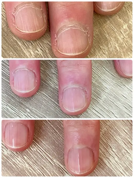 指先コンプレックス解消！美爪育成ネイルケア