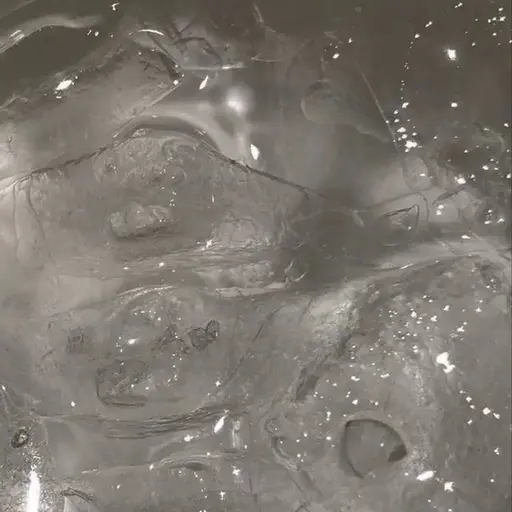 【🎀1月限定価格🎀】ショートヘッドスパ