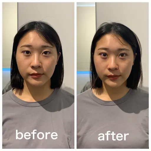 【変化実感No.1】エラ張り/顎の歪み＋小顔矯正/姿勢矯正【50分17900→2900】