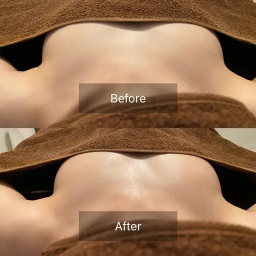 人気No. 1🌟\理想のバストになりたい方/ボリュームUP・ハリ・弾力・下垂・左右差改善!! ふわふわバストケア