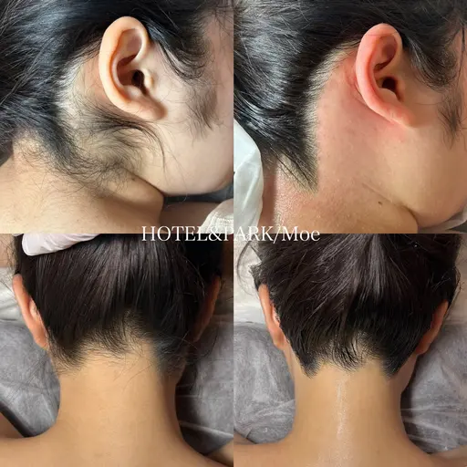 成人式前人気No.1👘【うなじ+もみあげワックス脱毛】