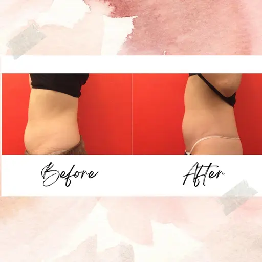 【お腹周りすっきり🌟】オールハンド腸マッサージモニター募集\4,000