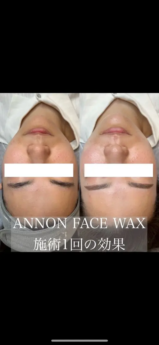 Facial wax