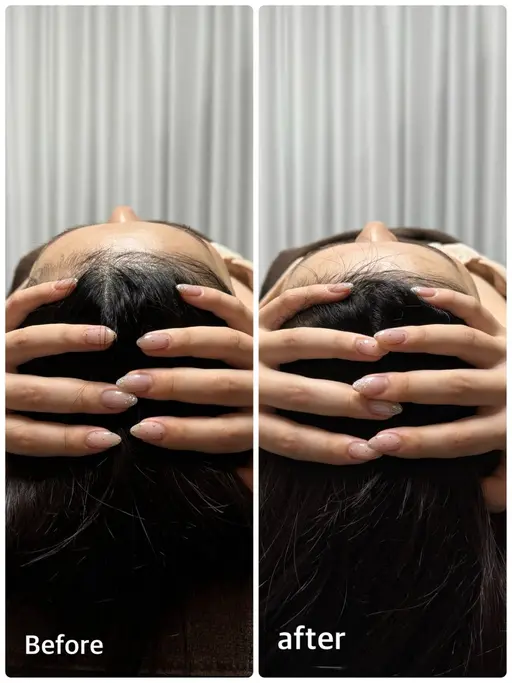 【究極の小顔コース!!】頭蓋骨矯正付き100min✨