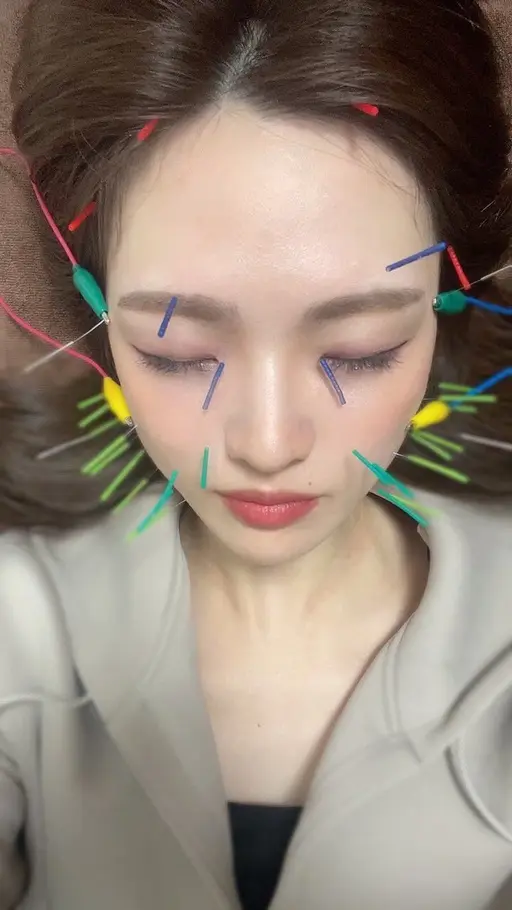 🌻最強小顔コース🌻美容鍼＋小顔矯正＋リンパマッサージ