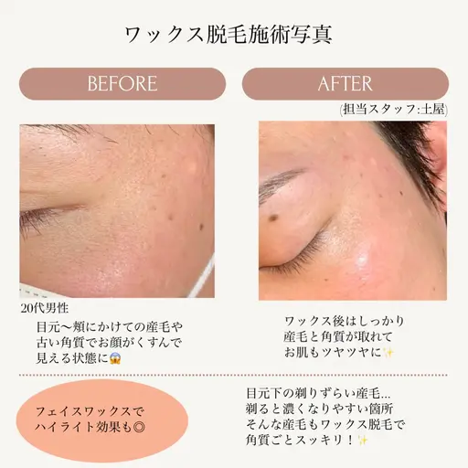 眉毛Wax脱毛×お顔のWax脱毛(美肌パック付)