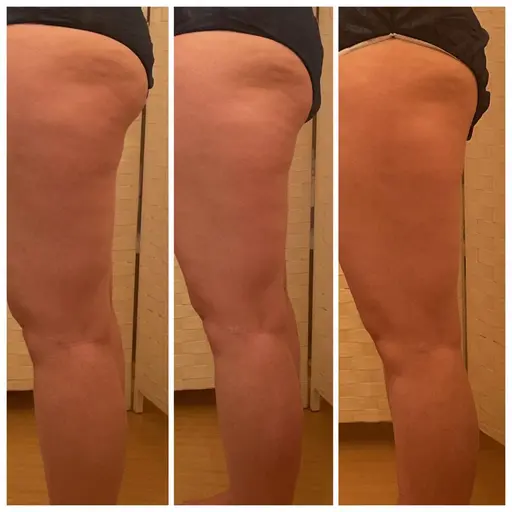 【ミニモ限定:下半身】ふくらはぎ、太もも前・後　【60分】太もも凸凹や脚の浮腫みに！すっきり美脚★