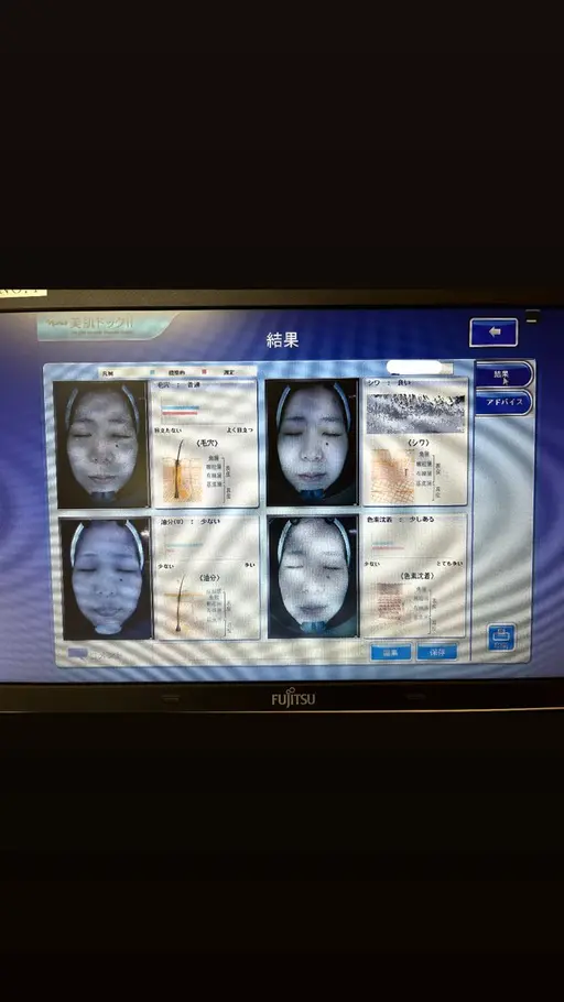 【先着3名様限定 特別価格】肌年齢や将来のシミ、毛穴の個数までわかる本格肌診断