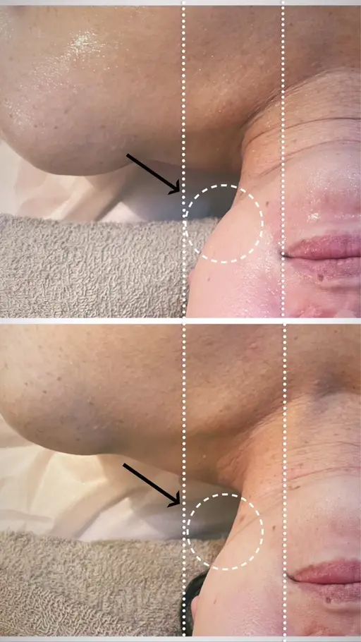 浮腫みたるみ撃退!!【小顔フェイシャル+ドライヘッドスパ+デコルテ首肩オイルマッサージ 】 110分