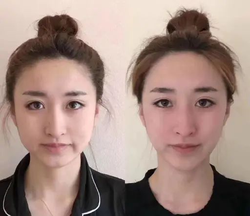 小顔美肌 :90分8000円。60分6000円(美容パック無し)