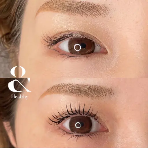 ＆ヘルシー　120本コース