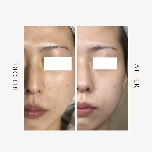 【初回限定】むくみ・くすみ改善✨即効フェイシャル ¥3,000