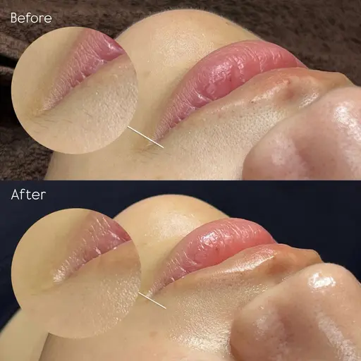 艶肌になれるフルフェイスワックス🥚✨(鎮静パック付)