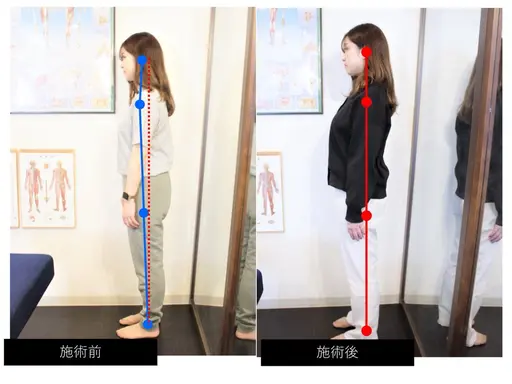 🔷肩こり【胸椎✖️肋骨リフト】背中でマイナス5歳若見え❗️🔷肩甲骨はがし🔷疲労回復🔷カイロで叶える美人化計画❗️