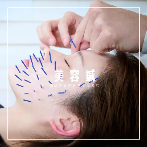 初回限定❄️美容鍼80本コース《冬の集中保湿美肌ケア》お顔の土台から整え、血色アップ小顔&うるツヤ肌