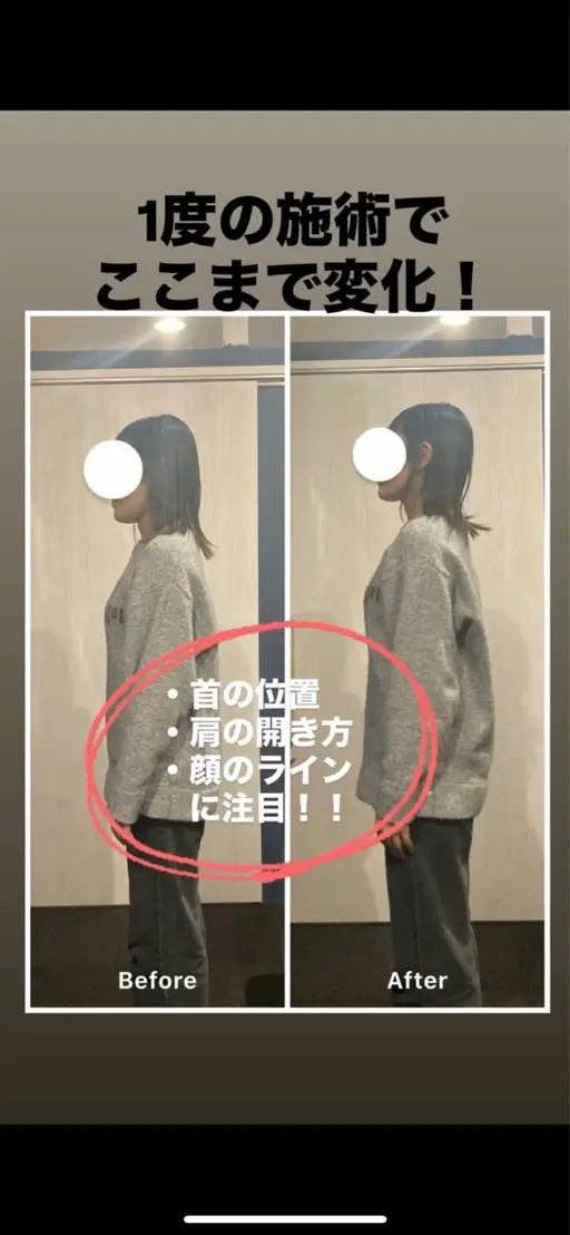 肩こりが酷い方限定！！肩こりスッキリ改善整体