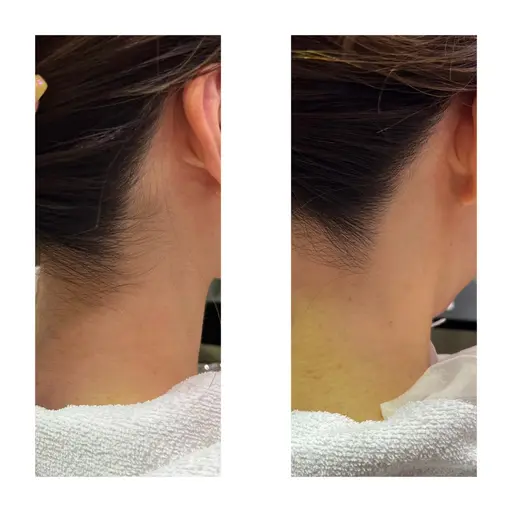 うなじシェービング