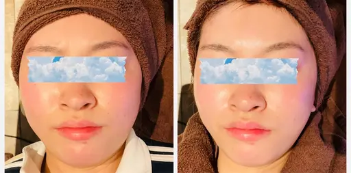 お顔スッキリ小顔メニュー